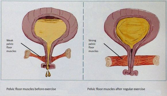 Pelvic Floor Muscle Exercises Dare To Age Well